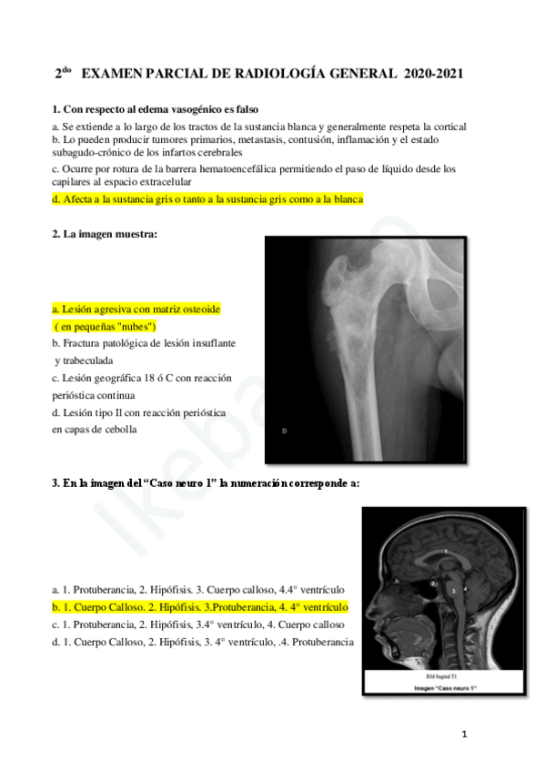 Miniatura del documento 2do-EXAMEN-PARCIAL-DE-RADIOLOGIA-GENERAL-2020-2021.pdf