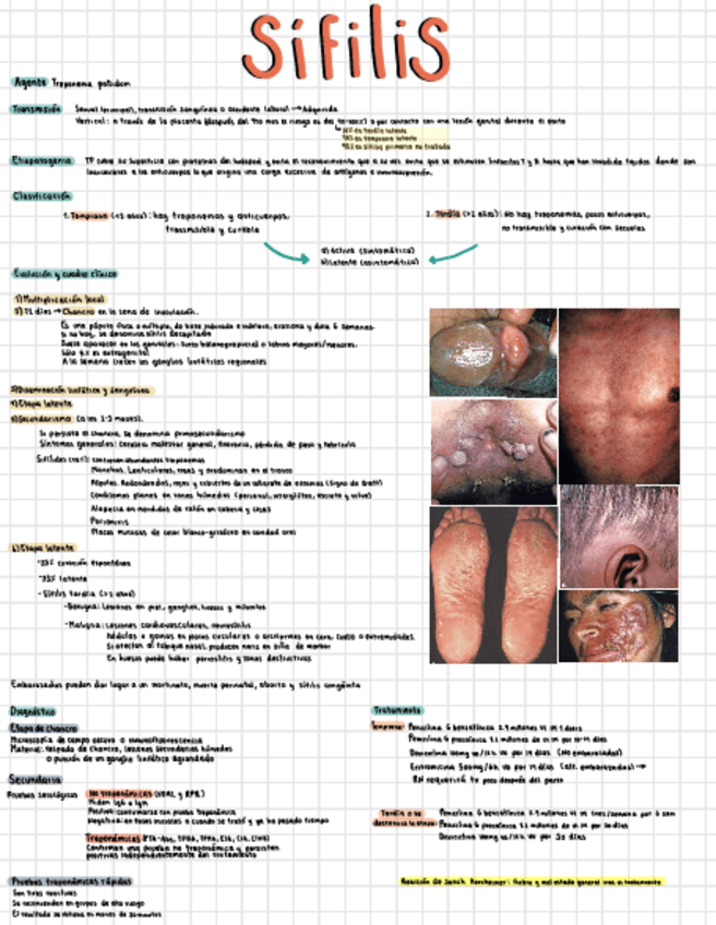 Miniatura del documento Sifilis.pdf