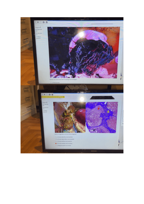 Miniatura del documento EXAMEN-APE-RESPONDUS.pdf