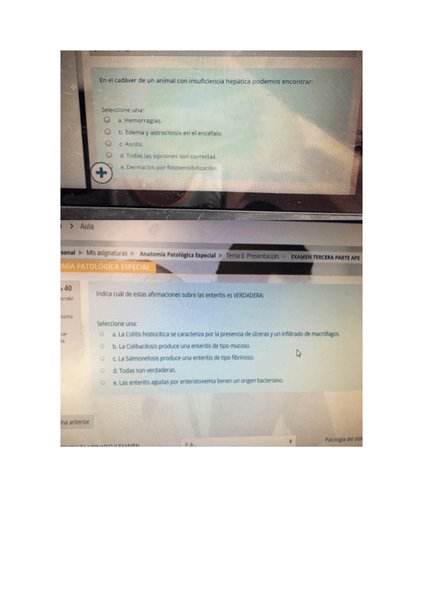 Miniatura del documento EXAMEN-RESPONDUS-APE-3-PARCIAL.pdf