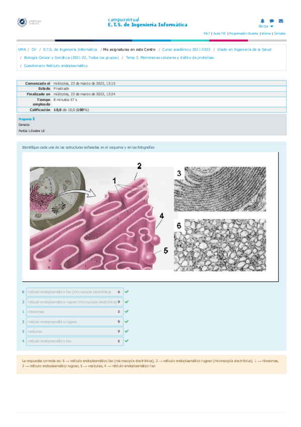 Miniatura del documento Cuestionario-Reticulo-Endoplasmatico.pdf