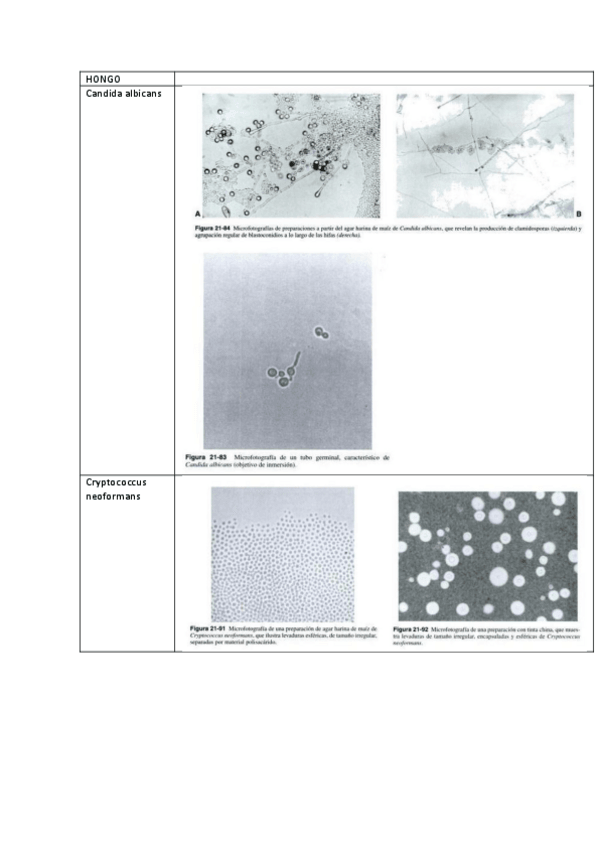 Miniatura del documento Imágenes Hongos Levaduriformes.pdf