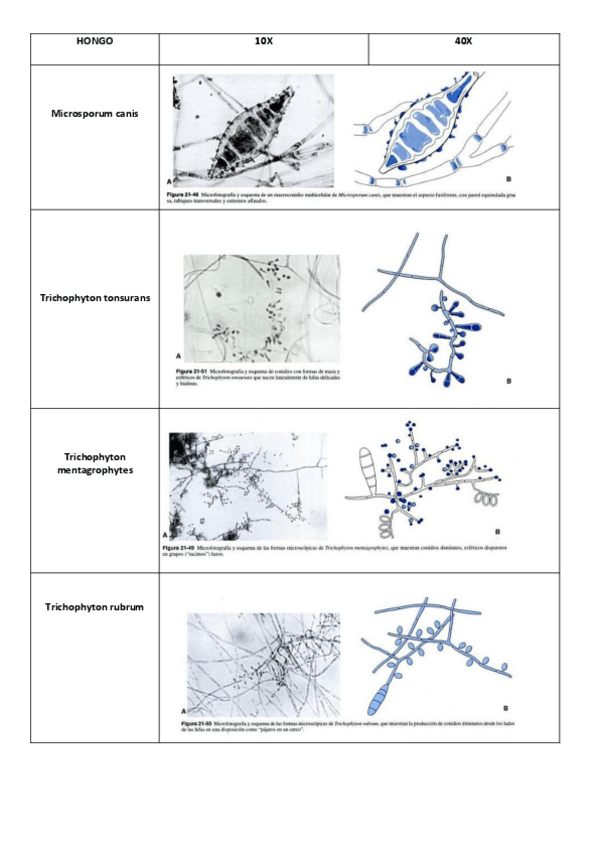 Miniatura del documento Imágenes Hongos filamentosos septados.pdf
