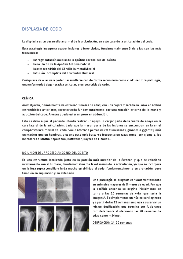 Miniatura del documento Seminario-Displasia-de-codo.pdf