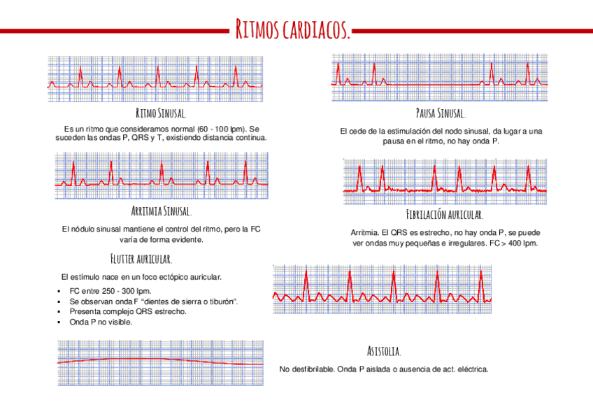 Miniatura del documento Ejercicios-arritmias.pdf