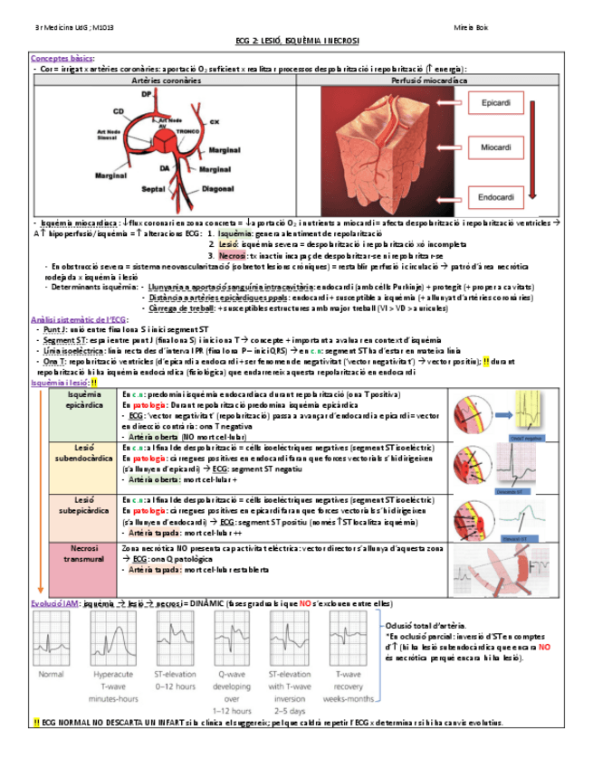 Miniatura del documento ECG-2.pdf
