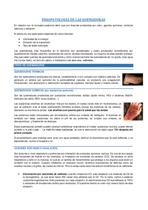 Miniatura del documento FISIOPATOLOGIA-DE-LAS-QUEMADURAS.pdf