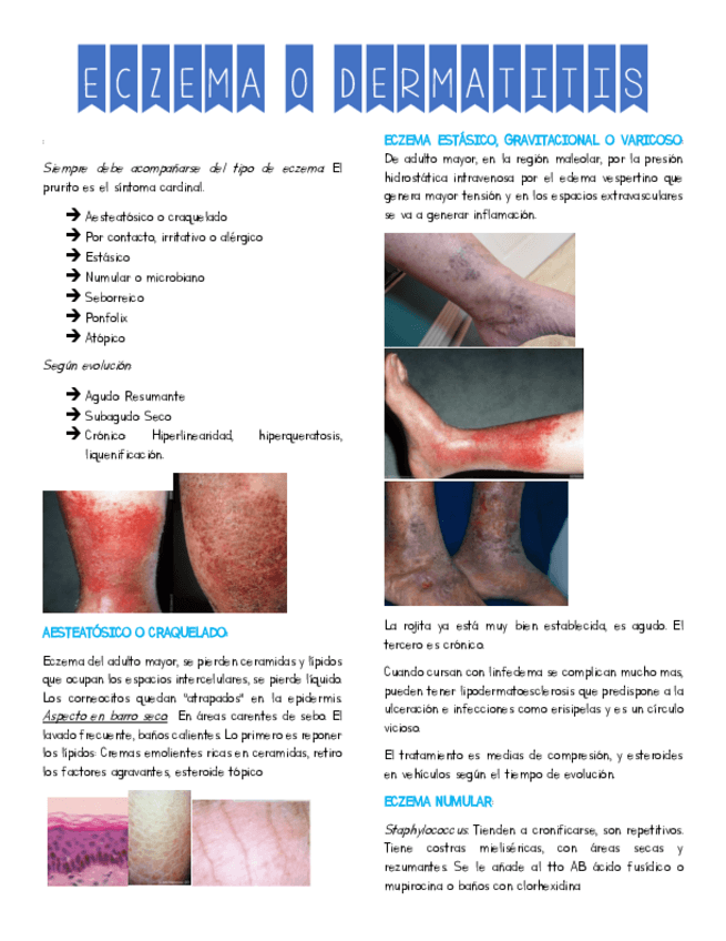 Miniatura del documento 2ECZEMAS.pdf