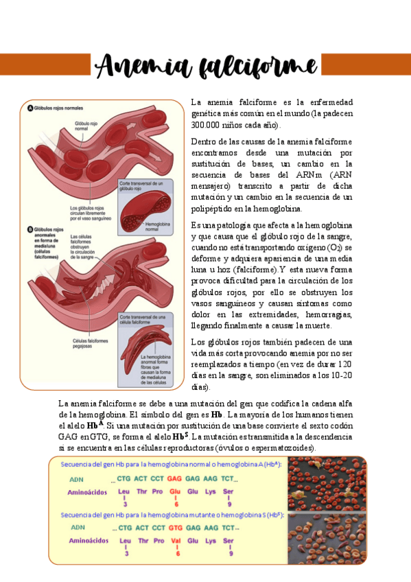 Miniatura del documento Anemia-falciforme.pdf