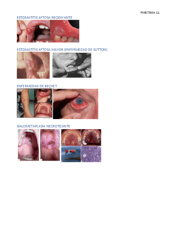 Miniatura del documento PMB-TEMA-11.pdf
