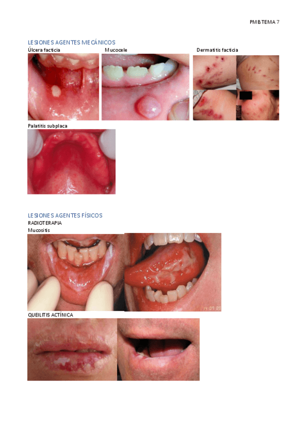 Miniatura del documento PMB-tema-7.pdf