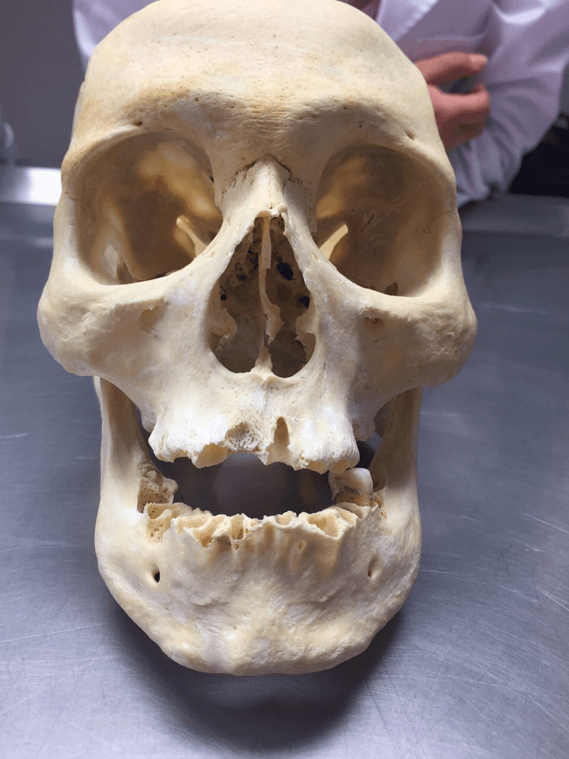 Miniatura del documento IMG_9250.JPG