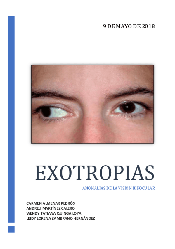 Miniatura del documento EXOTROPIAS-ANOMALIAS-DE-LA-VISION.pdf