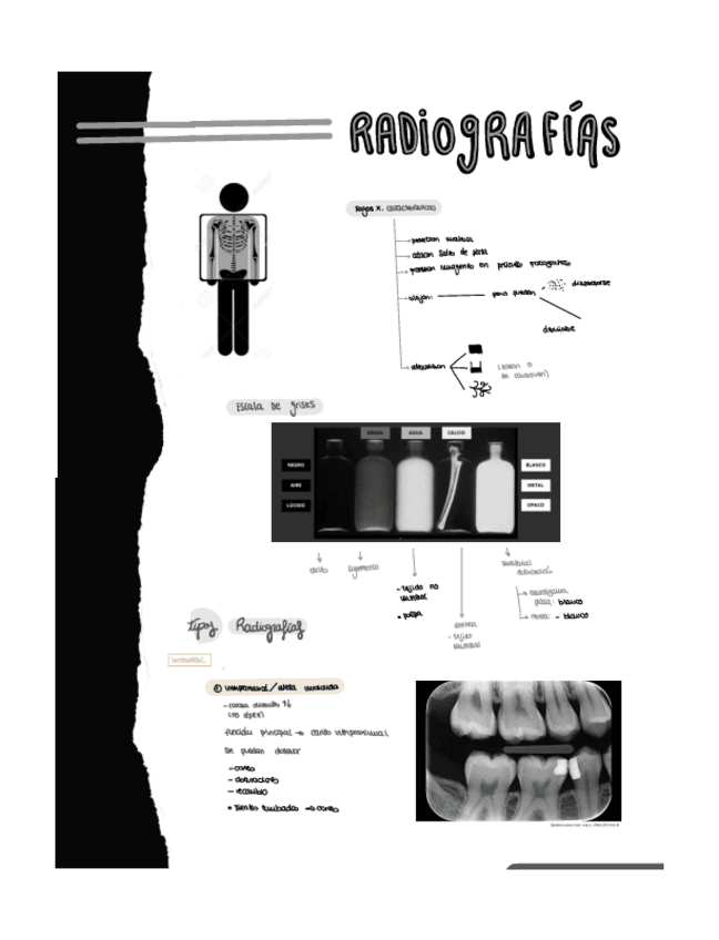 Miniatura del documento Radiografias-.pdf