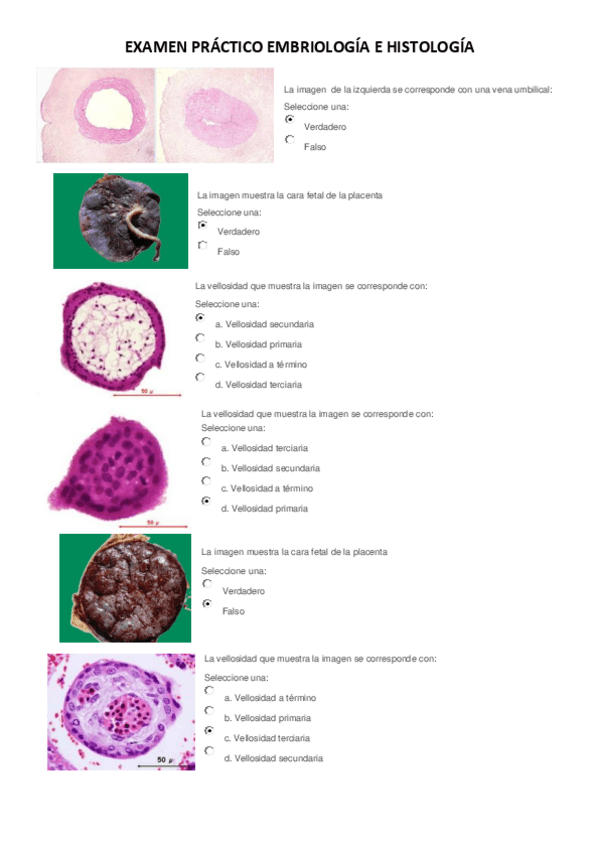 Miniatura del documento EXAMEN PRÁCTICO EMBRIOLOGÍA E HISTOLOGÍA1.pdf