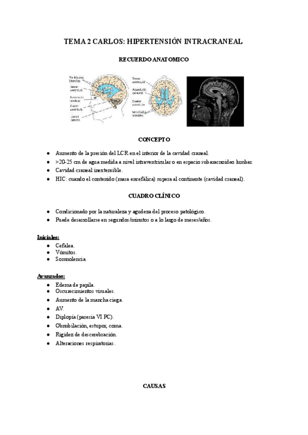 Miniatura del documento Hipertension-intracraneal.pdf