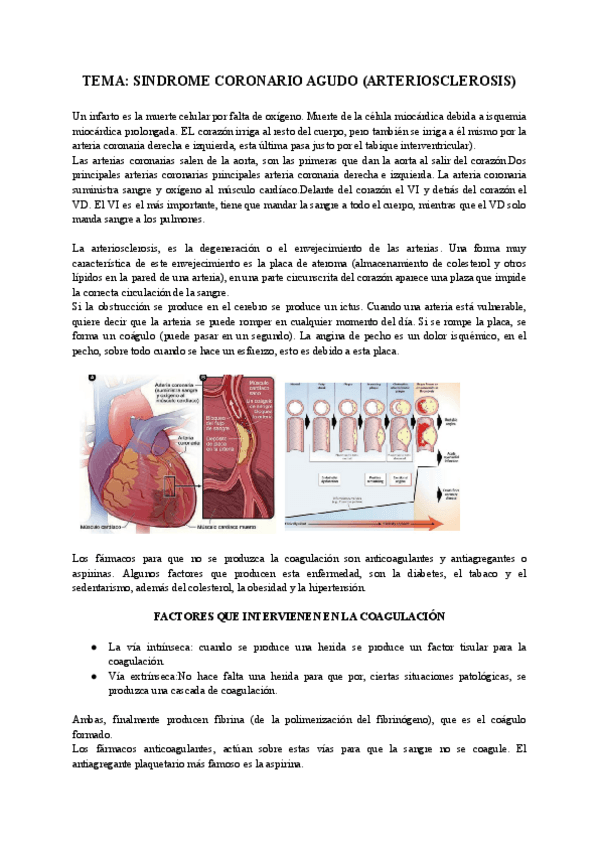 Miniatura del documento Sindrome-coronario-agudo.pdf