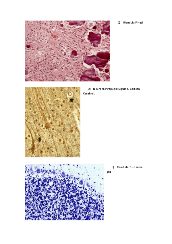 Miniatura del documento Examen Practico Histologia II Febrero.pdf