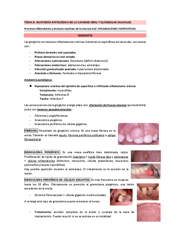 Miniatura del documento TEMA-8-ANATOMIA-PATOLOGICA-DE-LA-CAVIDAD-ORAL-Y-GLANDULAS-SALIVALES.pdf