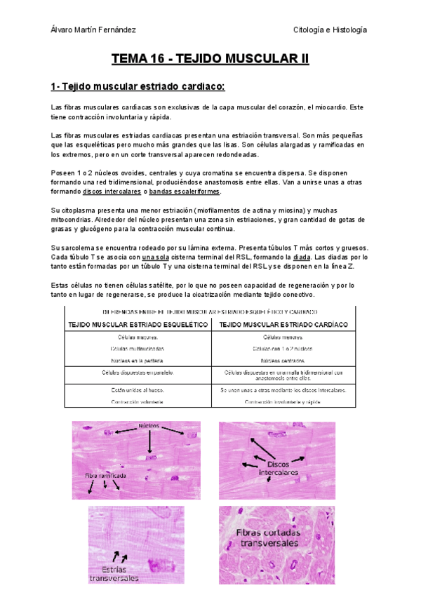 Miniatura del documento TEMA-16-TEJIDO-MUSCULAR-II.pdf
