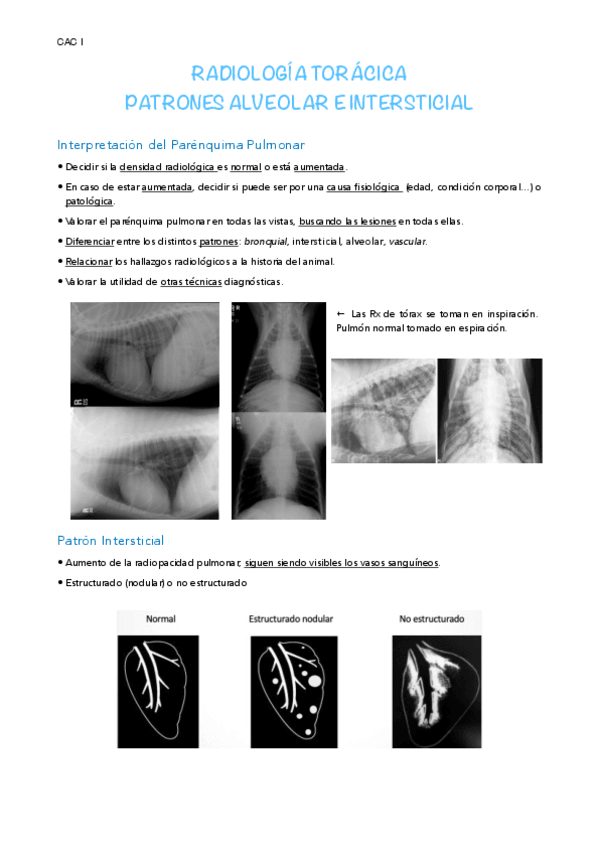 Miniatura del documento CM-DxI-Patrones-alveolar-e-intersticial.pdf