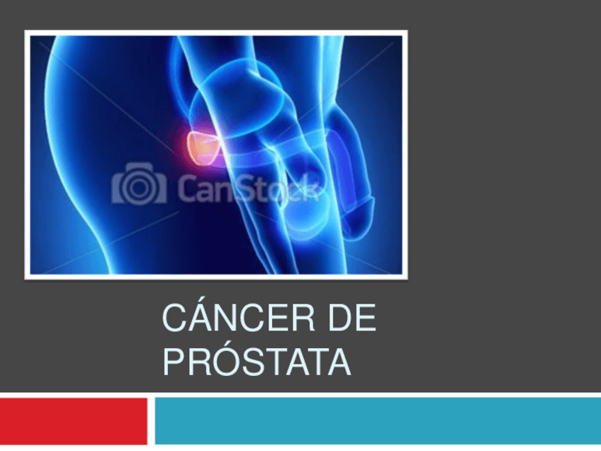 Miniatura del documento CANCER-DE-PROSTATA.pdf
