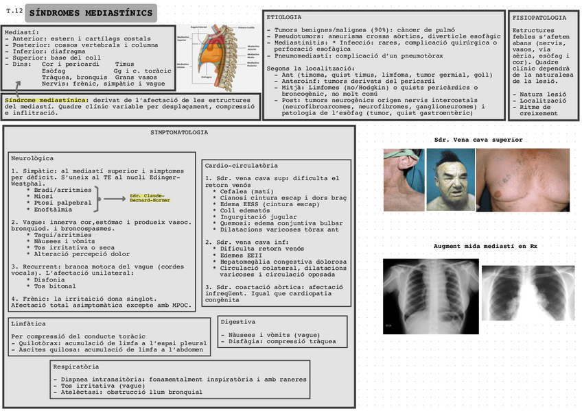 Miniatura del documento Sds-mediastinics.pdf