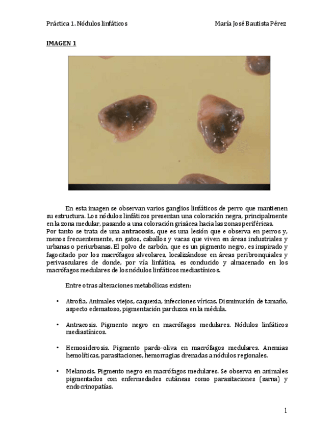 Miniatura del documento Práctica 1. Nódulos linfáticos COMPLETA.pdf