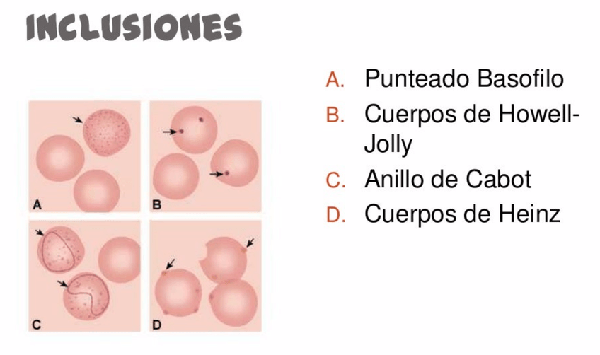 Miniatura del documento INLCUSIONES-HEMATO.png