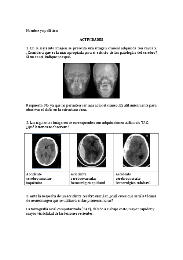Miniatura del documento Tarea-Neuroimagen.pdf