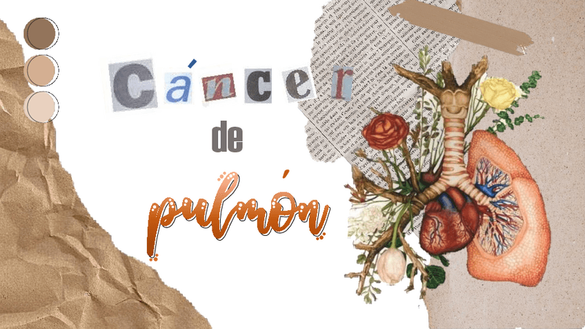 Miniatura del documento Cancer-de-pulmon-nuevo.pdf