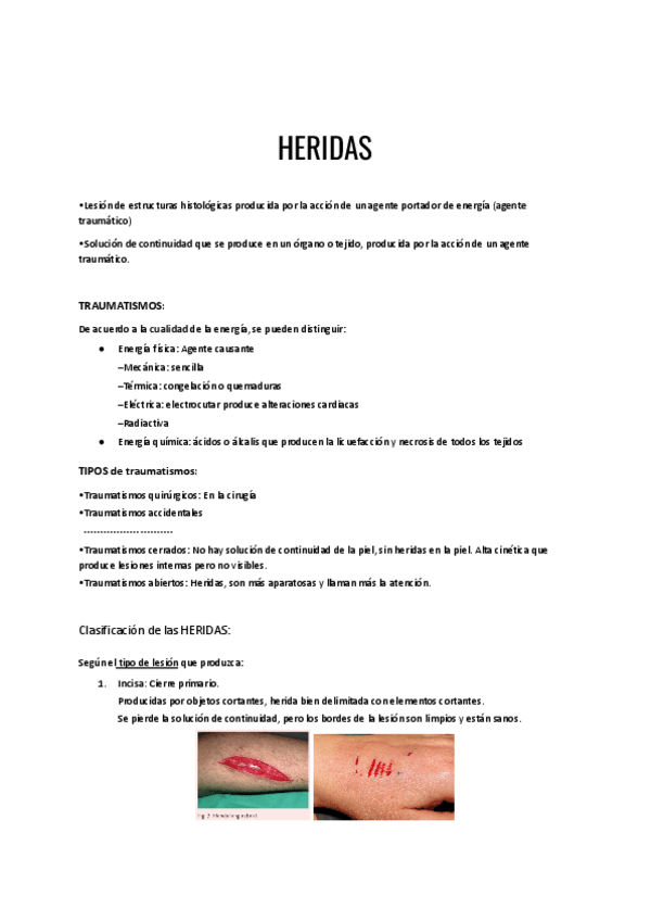 Miniatura del documento Heridas.pdf