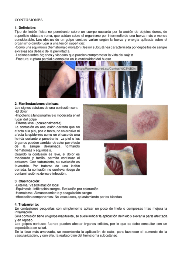 Miniatura del documento CONTUSIONES.pdf