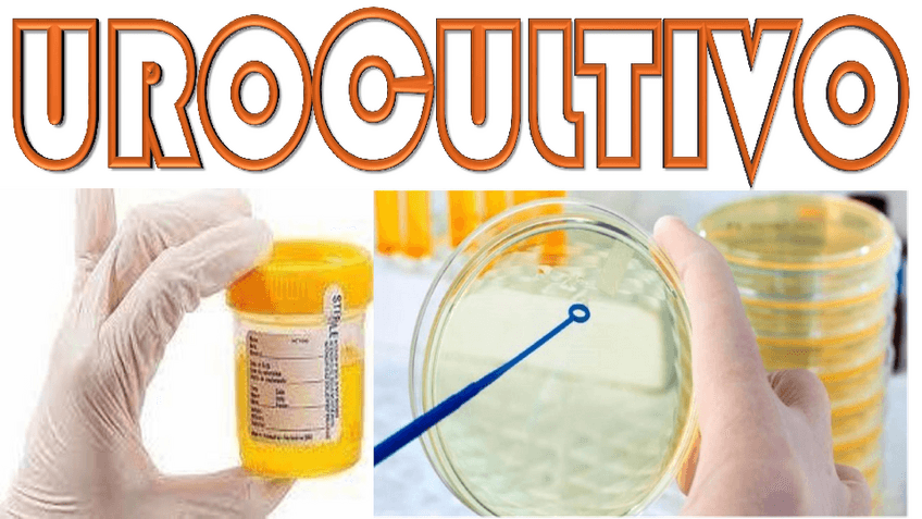 Miniatura del documento Urocultivo.pdf