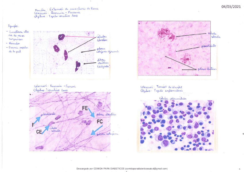 Miniatura del documento Tarea-DE-Tejido-Conectivo.pdf