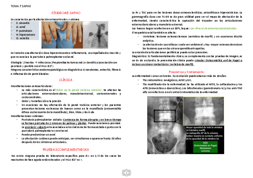 Miniatura del documento SINDROME-SAPHO.pdf