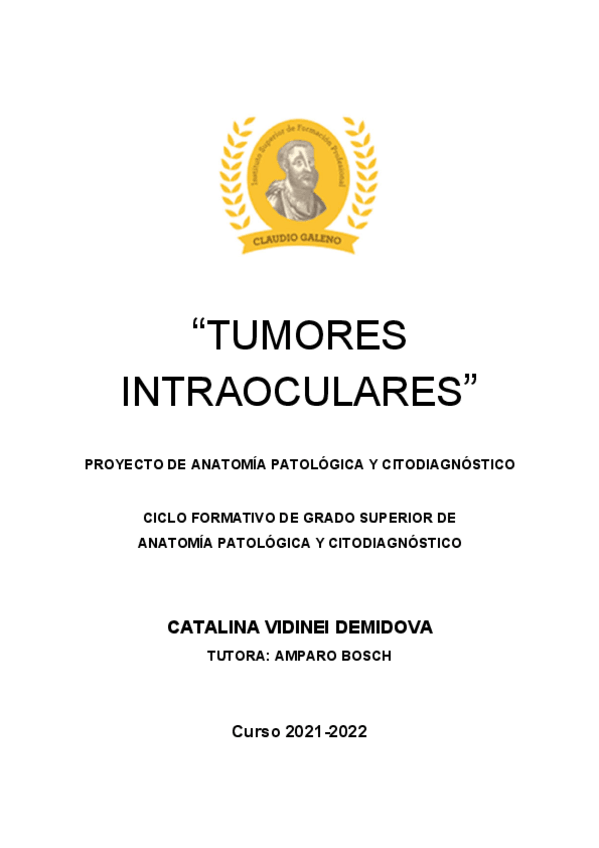 Miniatura del documento TUMORES-INTRAOCULARES.pdf
