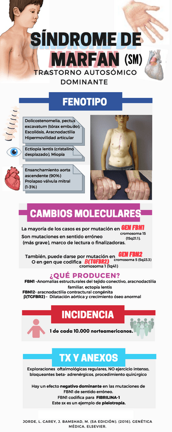 Miniatura del documento SINDROME-DE-MARFAN.pdf