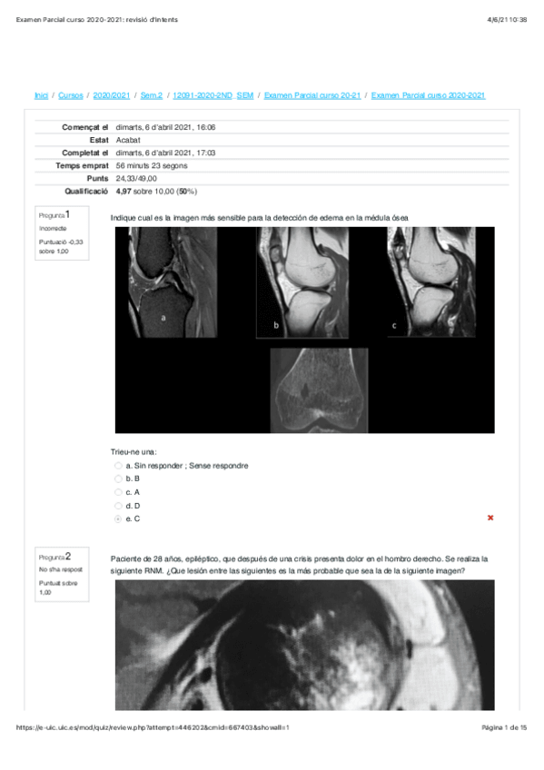 Miniatura del documento Examen-Parcial-TRAUMA-curso-2020-2021.pdf