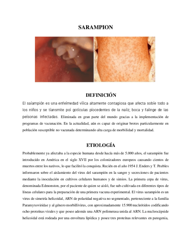 Miniatura del documento INFORME-SARAMPION-Y-RUBEOLA.pdf