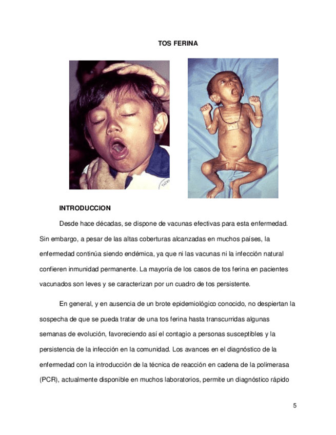 Miniatura del documento INFORME-TOS-FERINA-Y-COLERA.pdf