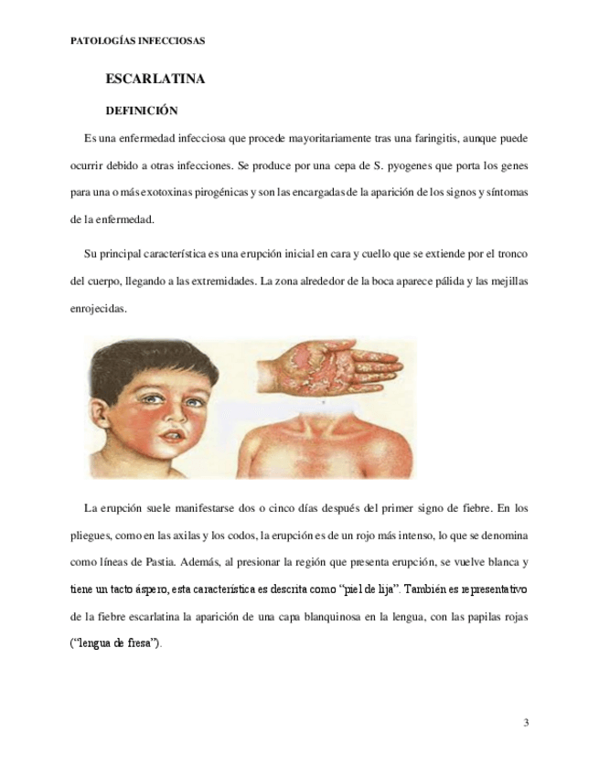 Miniatura del documento INFORME-ESCARLATINA-Y-TETANOS.pdf