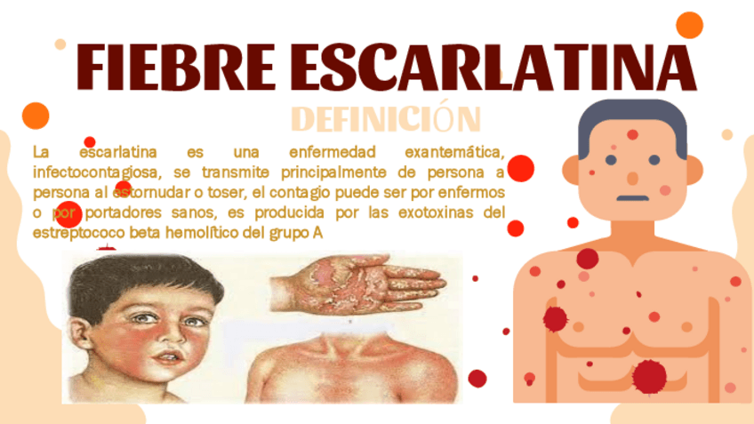 Miniatura del documento ESCARLATINA.pdf