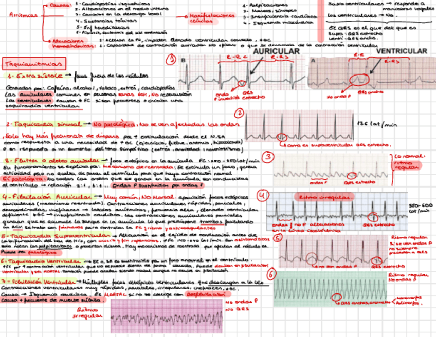 Miniatura del documento Esquema-Taquiarritmias.pdf