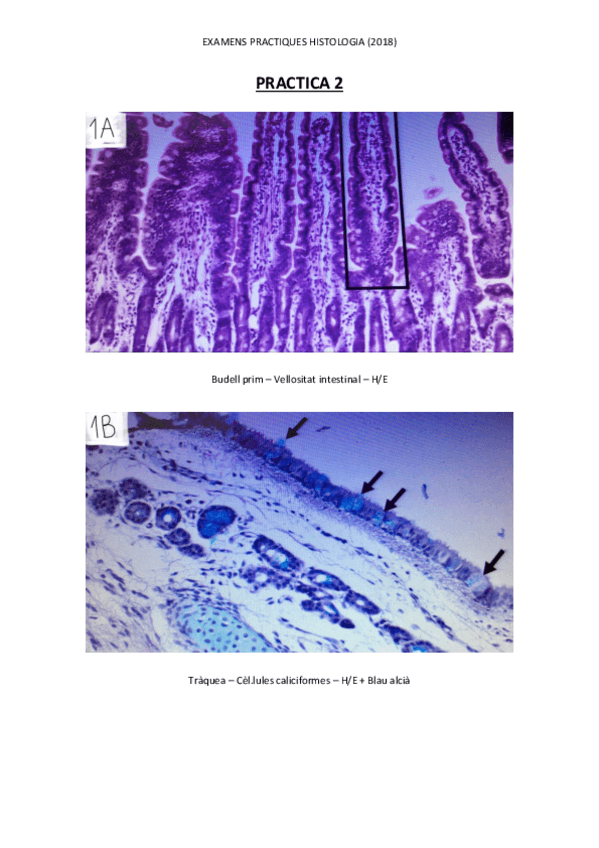 Miniatura del documento HISTOLOGIA-EXAMENS-IMATGES-PRACTIQUES.pdf