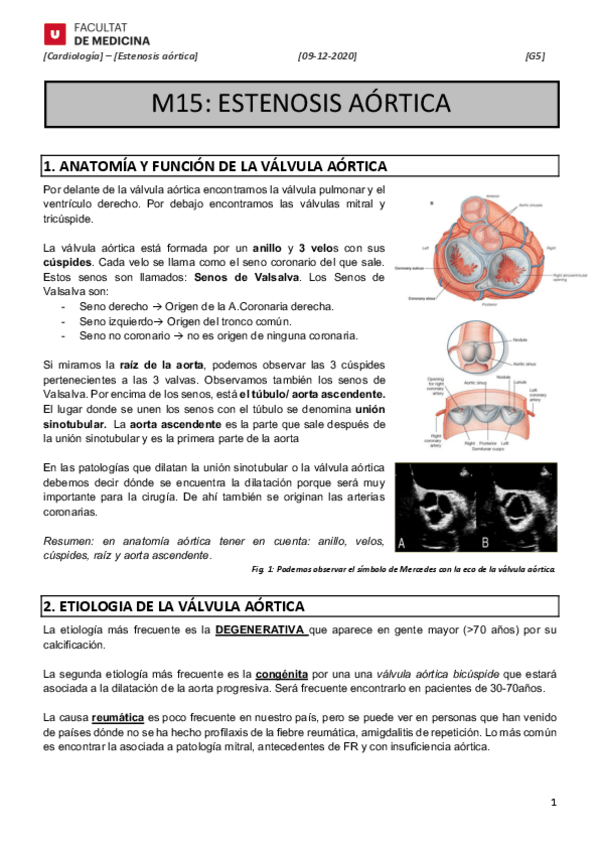 Miniatura del documento M15-ESTENOSIS-AORTICA.pdf