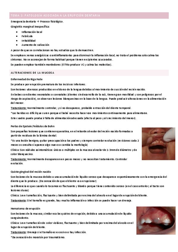 Miniatura del documento TEMA-3-Patologia-asociada-a-la-erupcion-dentaria.pdf