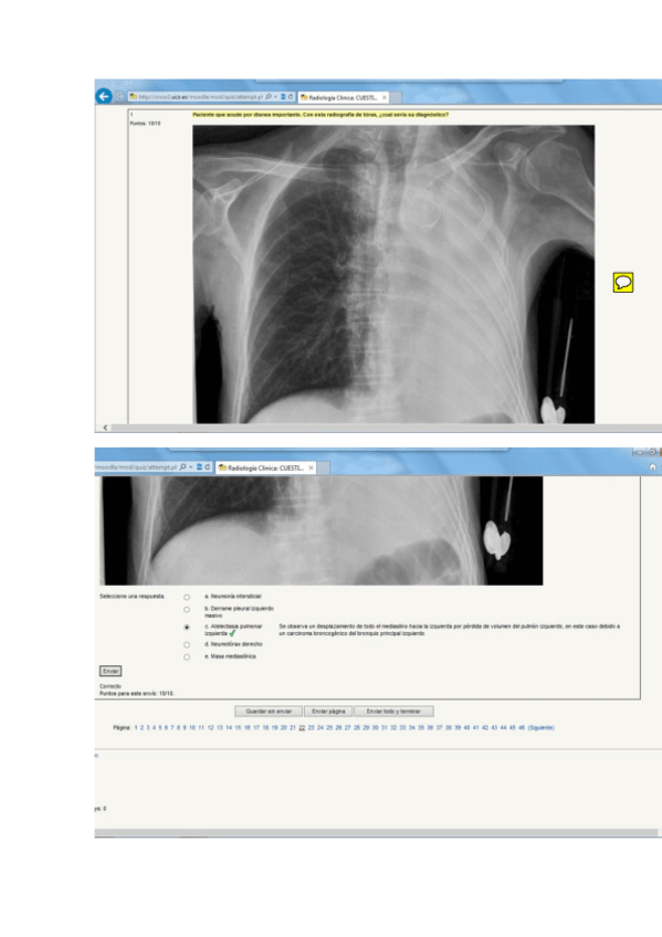 Miniatura del documento Test RadioDx.pdf