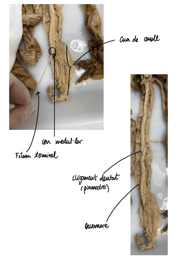 Miniatura del documento Anatomia-SN.pdf