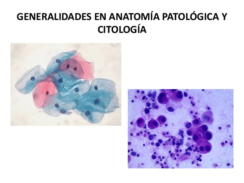 Miniatura del documento Generalidades-en-Anatomia-Patologica-y-Citologia.pdf